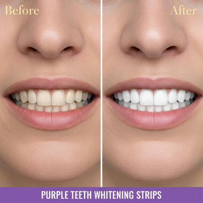 Purple Teeth Whitening Strips Brighten Tooth Remove Plaque Stain Cleaning Oral Hygiene Reduce Sensitivity Bleaching Dental Tools